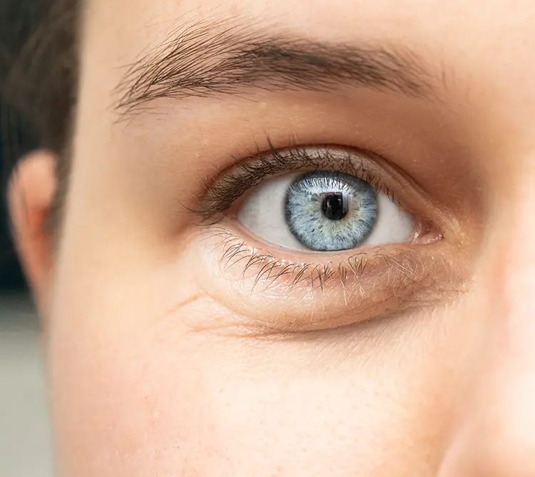 Chirurgia dello strabismo adulto